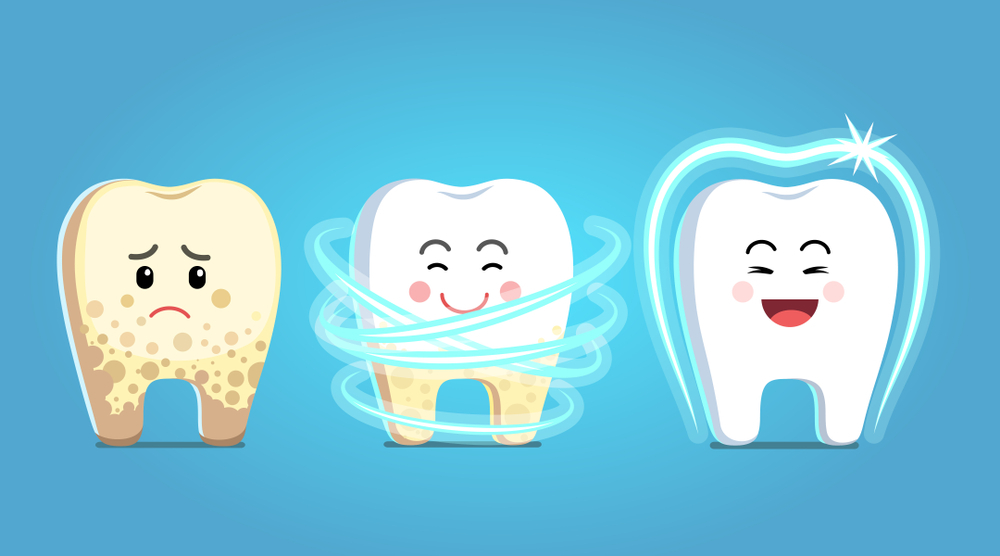 【黄色い歯】治す方法ってあるの？